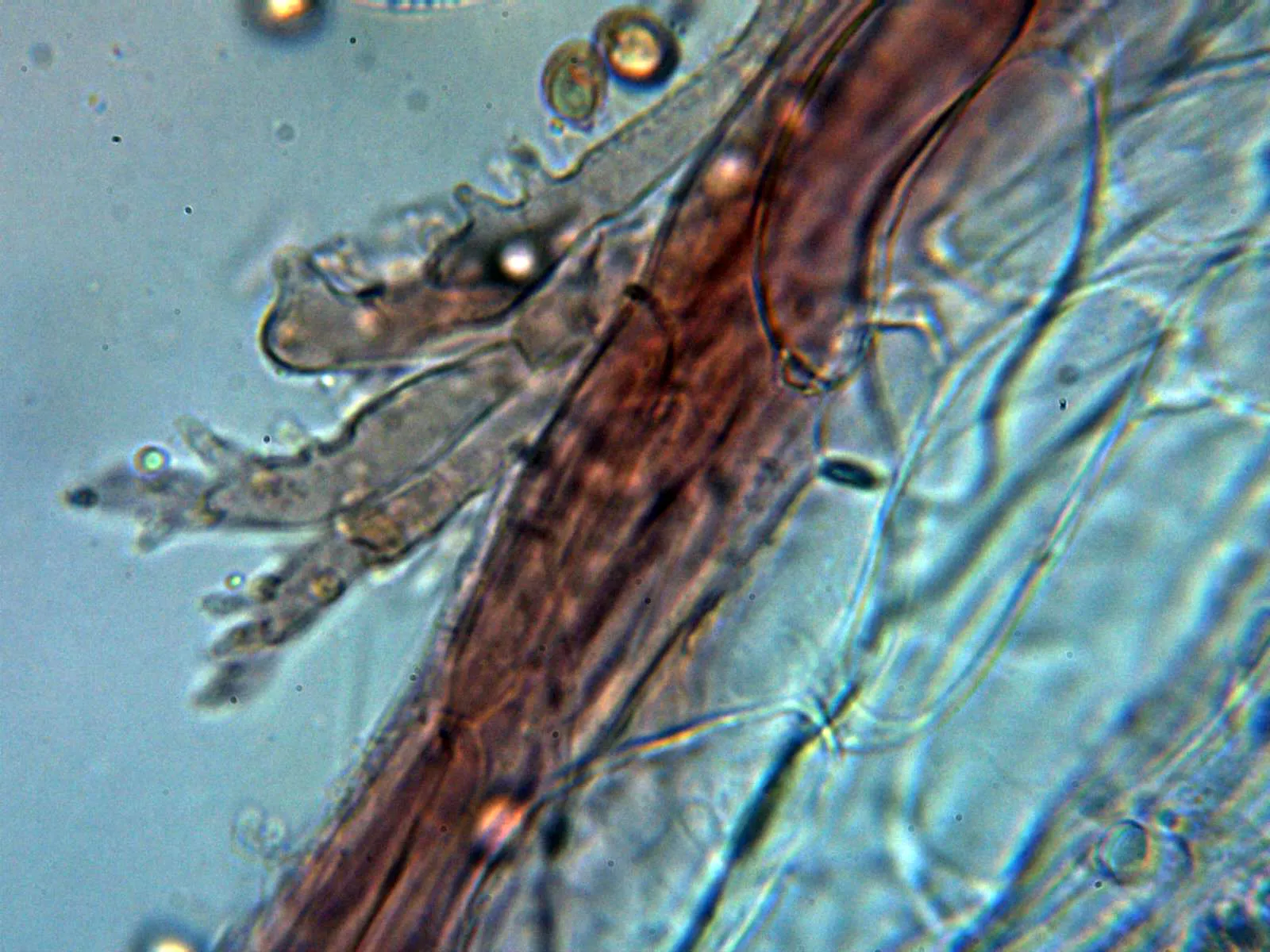 Microscopía de Phloeomana hiemalis - 11 - Suprapellis 1